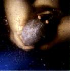 Aktiver Dammschutz der Mutter selbst